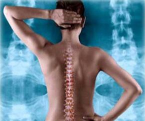 hátsó gerinc illusztráció