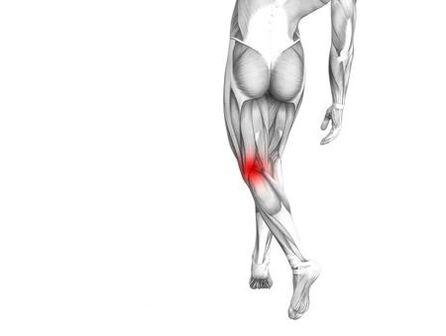 A térdízület osteoarthritis
