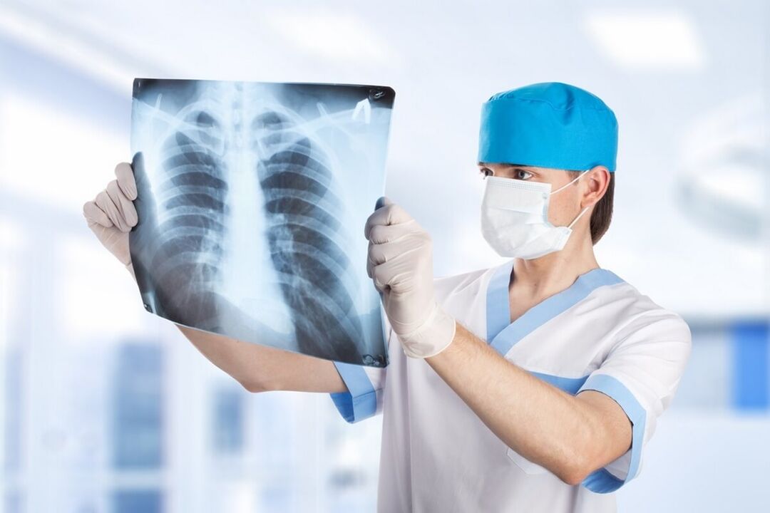 A mellkas röntgenfelvétele osteochondrosissal