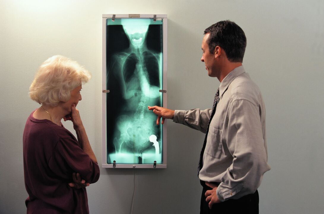 röntgendiagnózis a csípőízületi fájdalomra