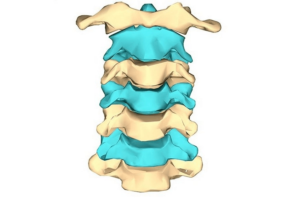 A nyaki osteochondrosis szakaszai
